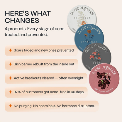 The Complete Acne Killer System 2.0
