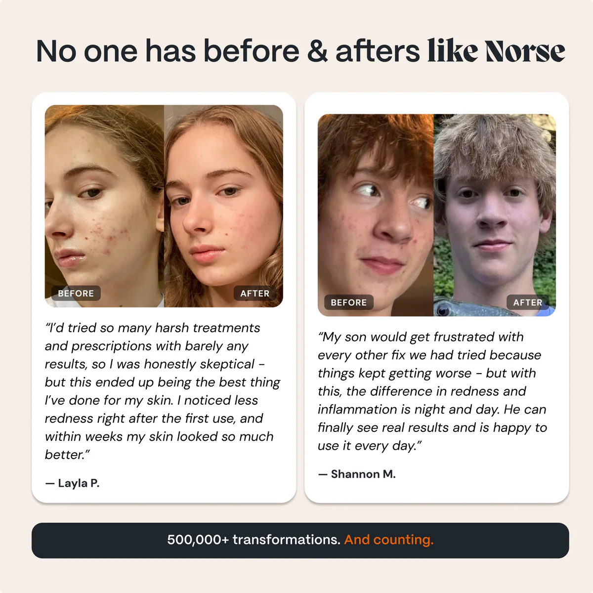 The Complete Acne Killer System 2.0