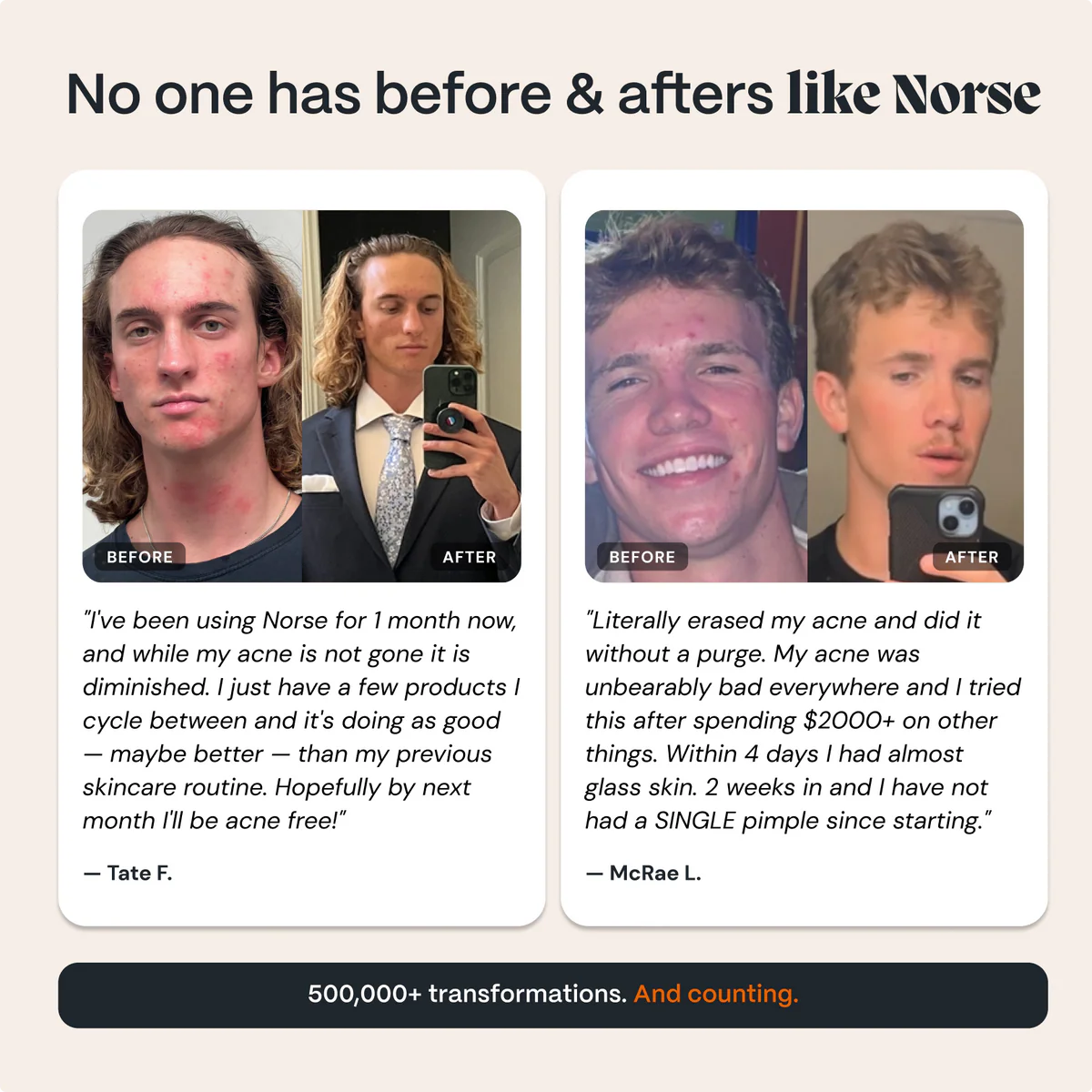 The Complete Acne Killer System 2.0